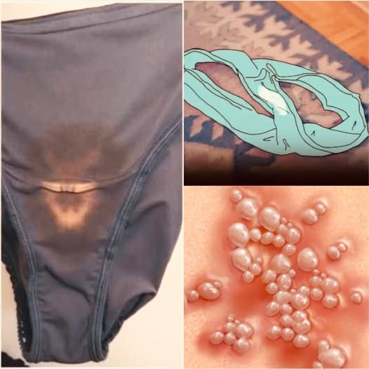 Underwear Stains Explained: When to Worry and When Not To