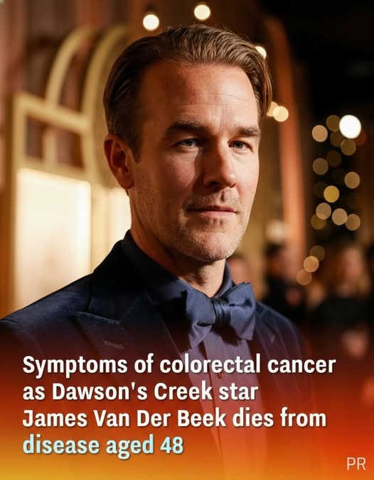 Common Symptoms of Colorectal Cancer Following the Passing of Actor James Van Der Beek at 48