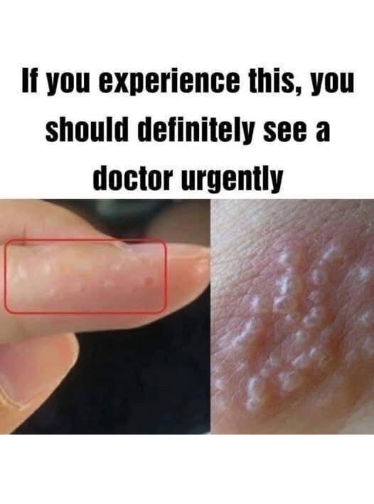 I Always Wondered What That Was… You Might Have This Skin Condition