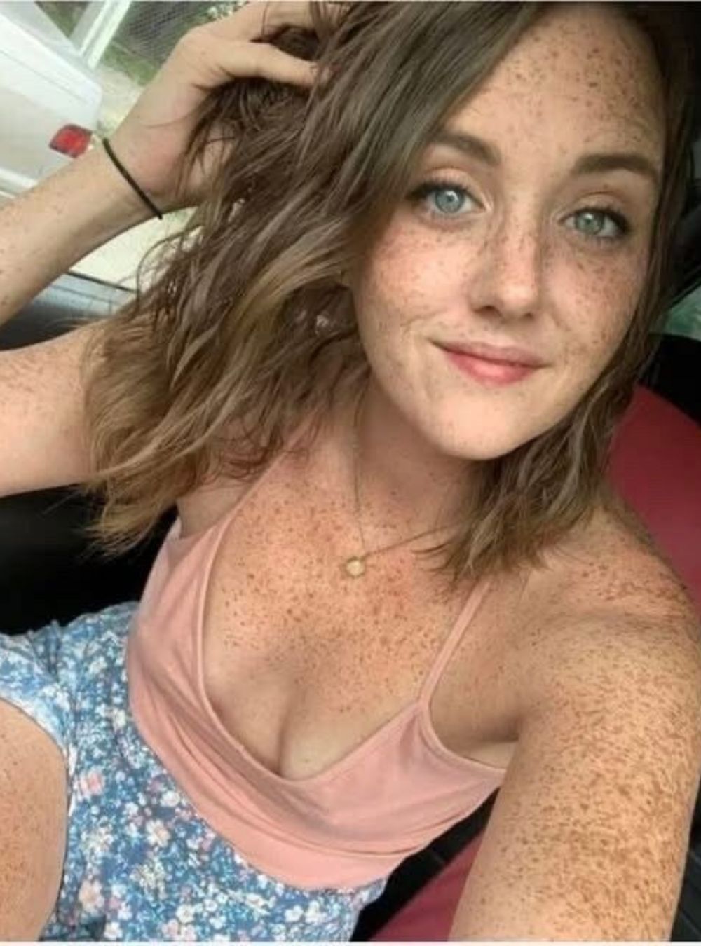 These Are the Consequences of Ignoring Unusual Genital Skin Changes… Read Carefully