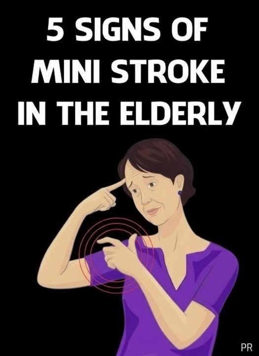 When Changes in Aging May Signal a Mini-Stroke: What to Look For