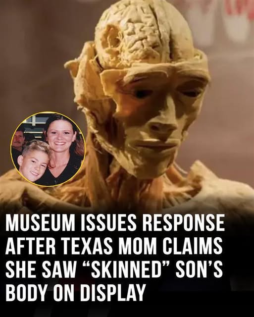 A museum has issued a formal response after a concerned mother claimed she saw what appeared to be her son’s “skinned” body on display during a recent visit. The institution addressed her alarming accusation by clarifying the origins and purpose of the exhibit, emphasizing its educational intentions and strict ethical standards. The incident has sparked intense public discussion, prompting further review and conversation about display practices.